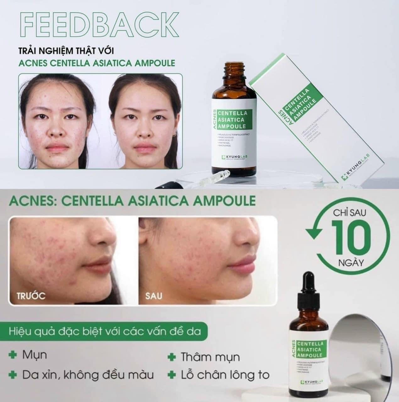 KYUNGLAB ACNES CENTELLA ASIATICA AMPOULE 50ml