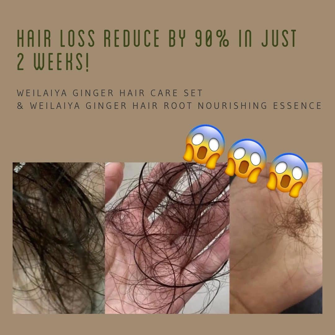 Set Weilaiya Ginger Hair Root Nourishing Essence Hair Growth Serum (5ml x 8 vials)